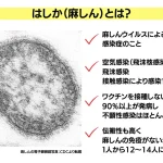 はしか感染の20代女性が韓国人気アイドル「SEVENTEEN」の東京ドーム公演に…