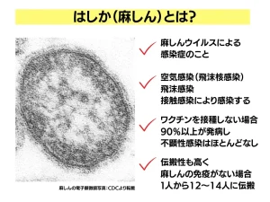 はしか感染の20代女性が韓国人気アイドル「SEVENTEEN」の東京ドーム公演に…